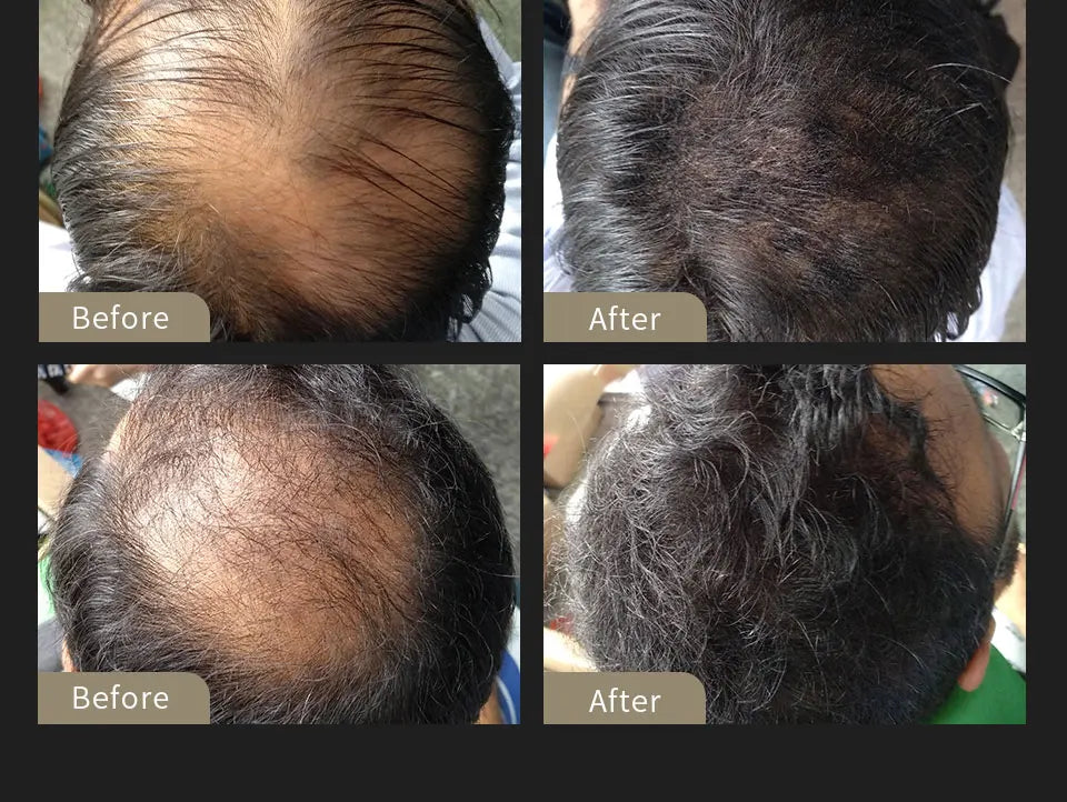 Fibres Capillaires à la Kératine SEVICH – Kit Densifiant pour Cheveux Clairsemés avec Applicateur